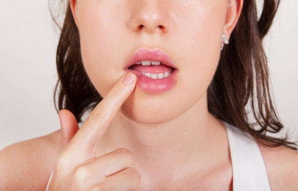 טיפול טבעי בהרפס